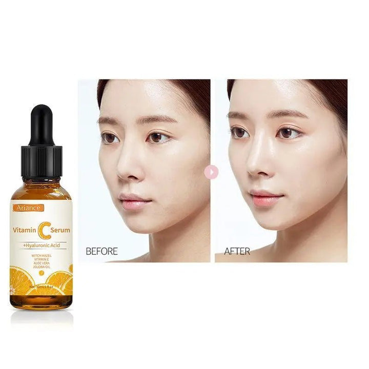 30ml French Golden Vitamin-C Serum